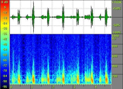 ASD in an 11-year-old child
